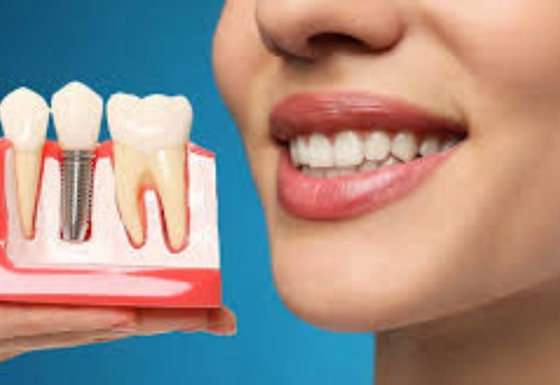 Diş kemiği erimelerine yeni çözüm