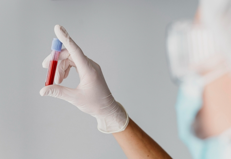 Hemofili nedir?