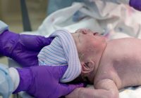 Mor bebek sendromuna dikkat!