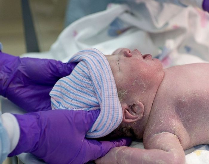 Mor bebek sendromuna dikkat!