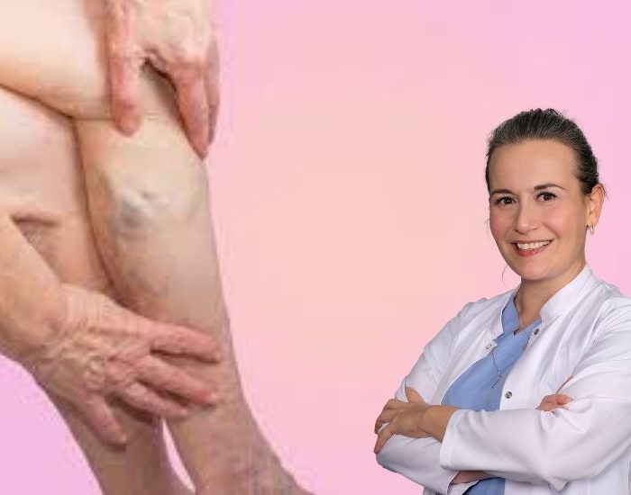 Varis kadınlarda 4 kat daha fazla görülüyor!