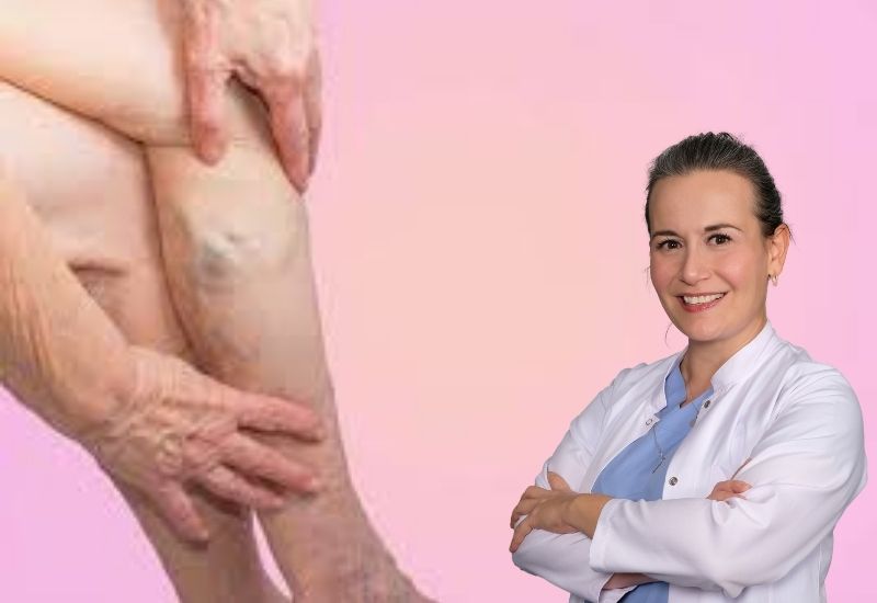 Varis kadınlarda 4 kat daha fazla görülüyor!