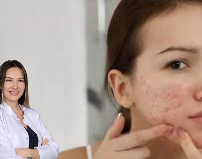 Akne hangi bölgede neye işaret ediyor?