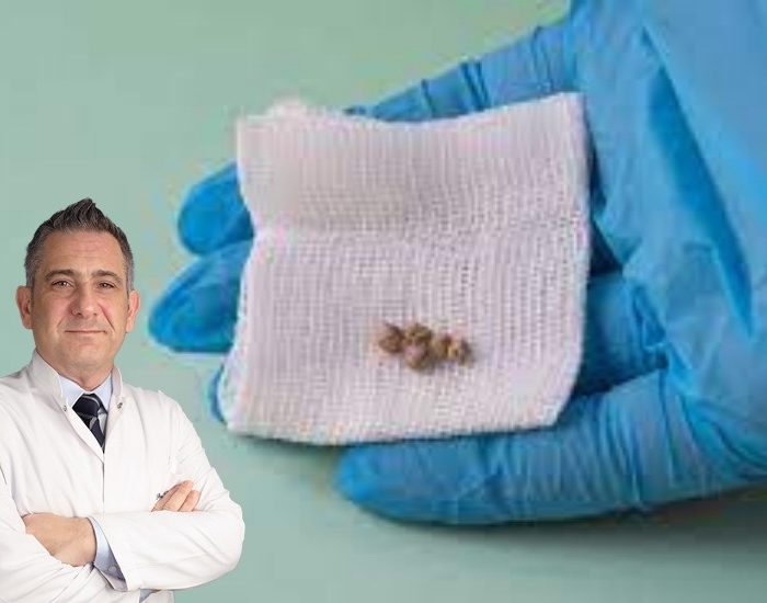 Et ağırlıklı beslenme safra taşı oluşumuna yol açabiliyor