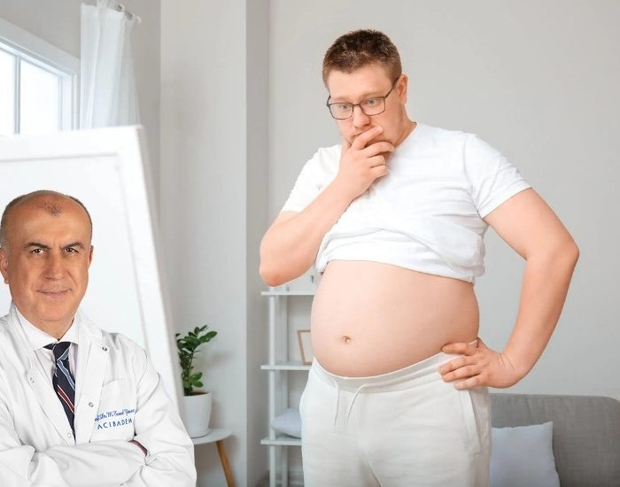 Ülkemizde 30 yaş üzerindeki her 3 kişiden 1’i obezite hastası!