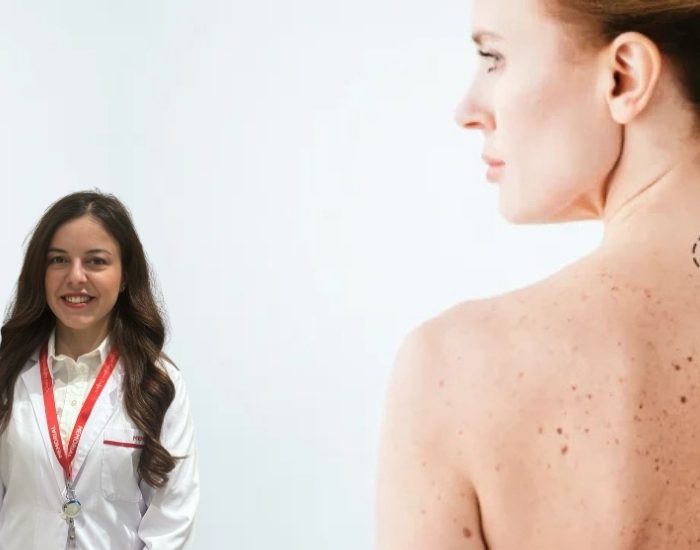 Cilt kanserinin 6 belirtisine dikkat!