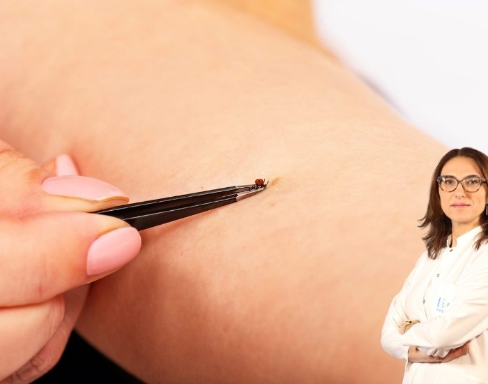 Keneden korunma yolları!