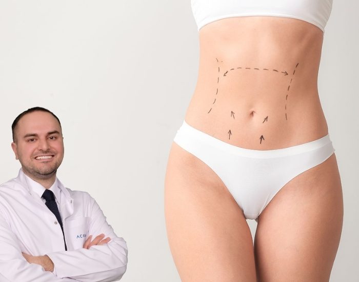 Karın germede izi dışarıdan fark edilmiyor!