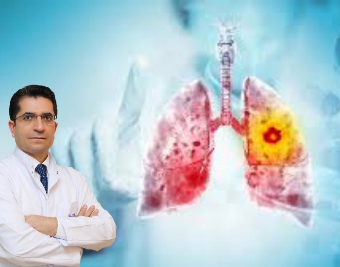 En etkili korunma yöntemi sigaradan uzak durmak!