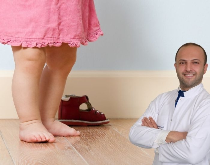 Düz taban her 10 çocuktan 7’sinde görülüyor!