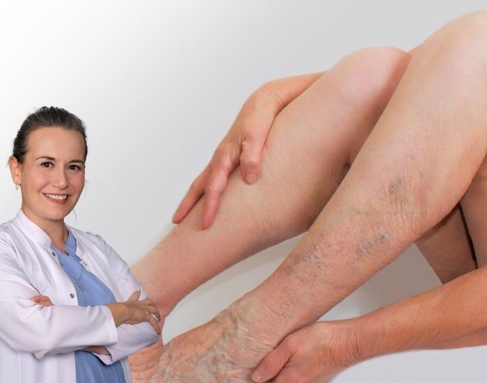 Varis son yıllarda hızla yaygınlaşıyor