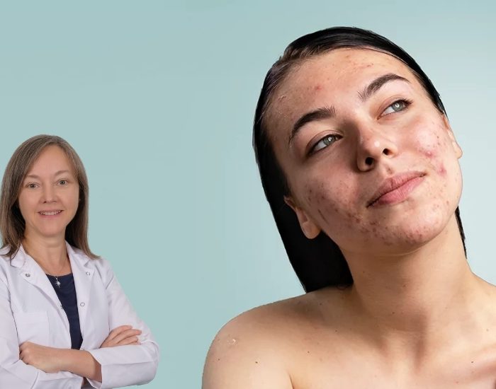 Geç kalan tedavi yüzde kalıcı izler bırakabiliyor!