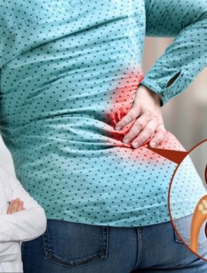 Kışın sinsi tehlikesi ‘böbrek taşı’ gençlerde de yaygınlaşıyor!