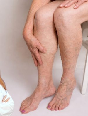 Dolaşım Sistemi Hastalıkları Hızla Yayılıyor