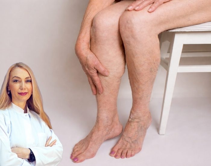 Dolaşım Sistemi Hastalıkları Hızla Yayılıyor