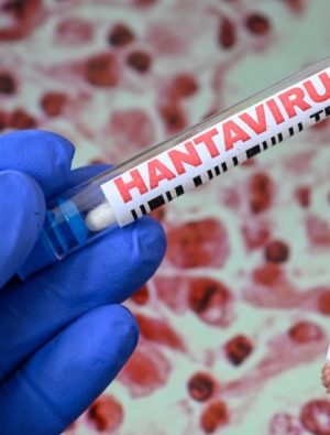 Riskli Alanlarda Toz Solumak Hantavirüs Tehlikesini Artırıyor