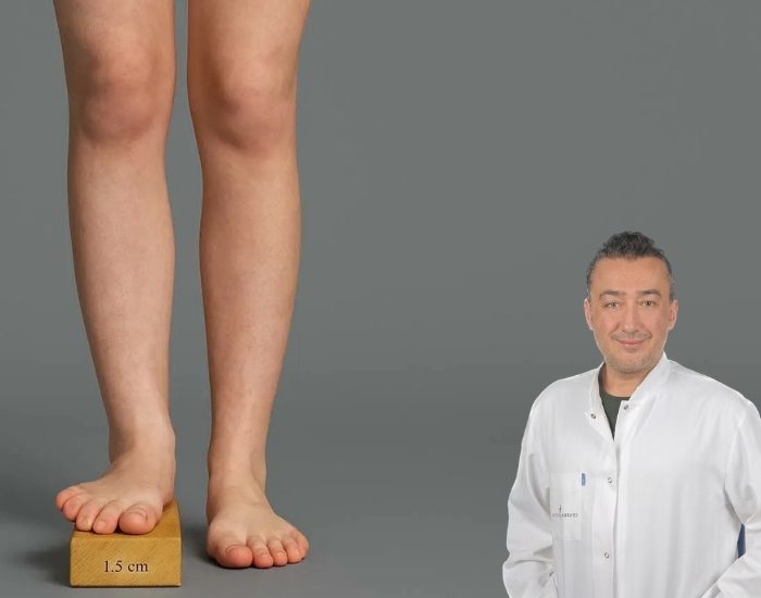 Bacak Boyu Eşitsizliği Omurga ve Eklem Sağlığını Tehdit Ediyor