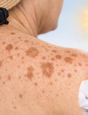 Dermatologlardan Bilimsel ve Pratik Öneriler